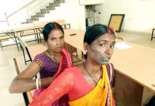 शादी के दस साल बाद भी दहेज प्रताडऩा, पत्नी पर डाला गर्म तेल